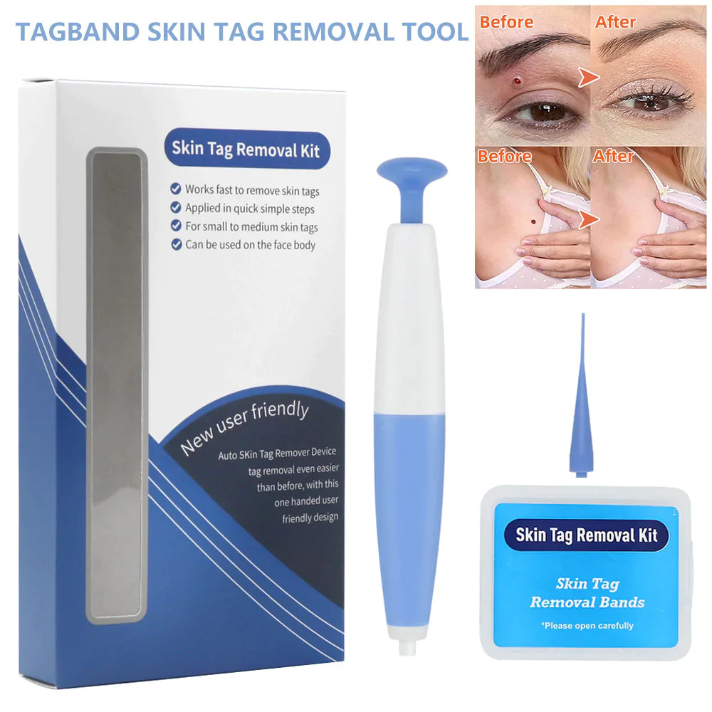 Skin Tag Removal Kit - FLUKLY STORE