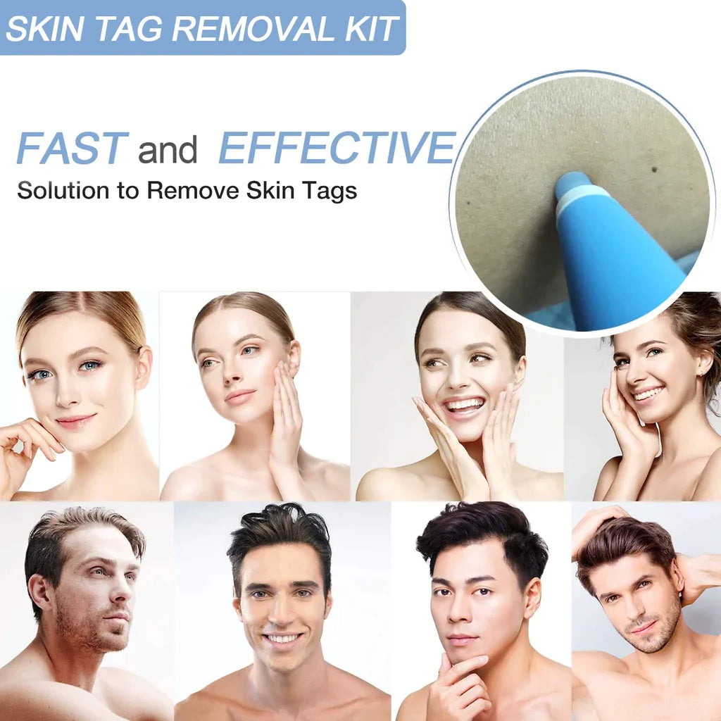 Skin Tag Removal Kit - FLUKLY STORE