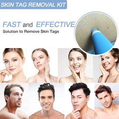 Skin Tag Removal Kit - FLUKLY STORE